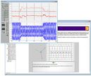 Interactive Lab Assistant : FRT pour Eoliennes MADA / DFIG